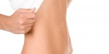 Abdominoplastia o cirugía plástica del abdomen